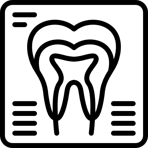 Graphic of scanned tooth showing nerves etc
