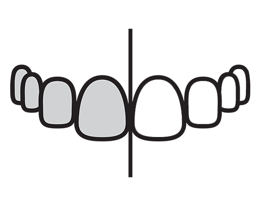 Graphic of half whitened and half non-whitened teeth